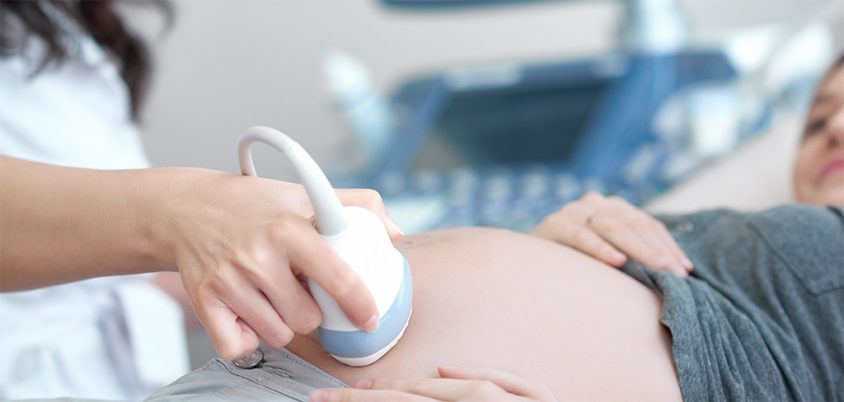 Ultraschalluntersuchung einer Schwangeren
